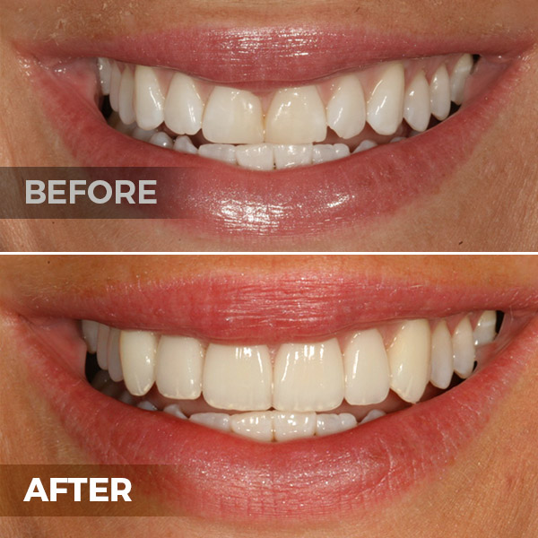 Heath Dental Group creates remarkable results